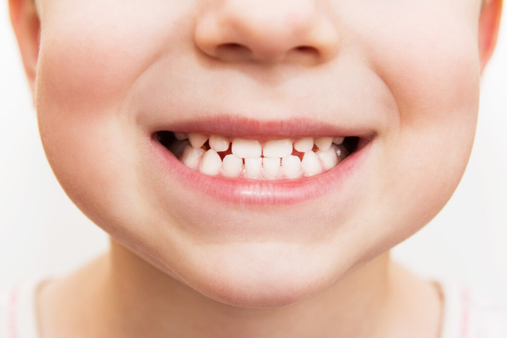 Early Interceptive Treatment