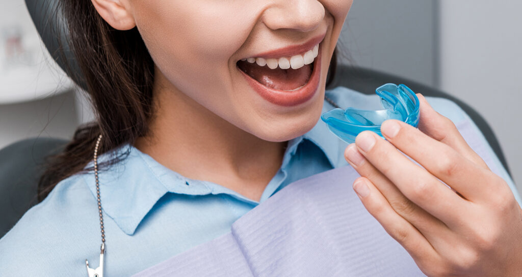 Adult Aligners