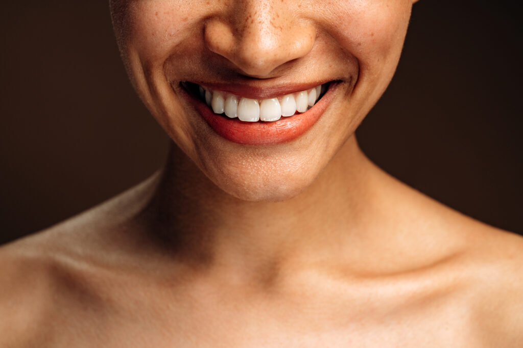 Tooth Contouring and Shaping