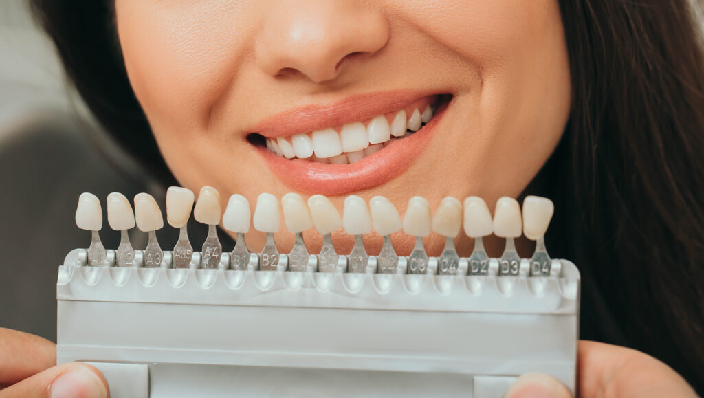 Teeth Whitening