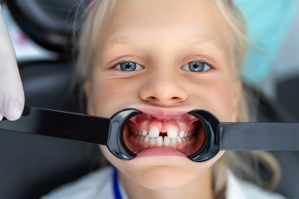 Kids Orthodontics